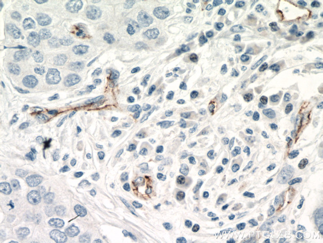 CDH5 Antibody in Immunohistochemistry (Paraffin) (IHC (P))