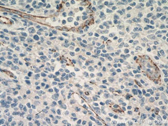 CDH5 Antibody in Immunohistochemistry (Paraffin) (IHC (P))