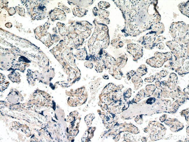 CDH5 Antibody in Immunohistochemistry (Paraffin) (IHC (P))