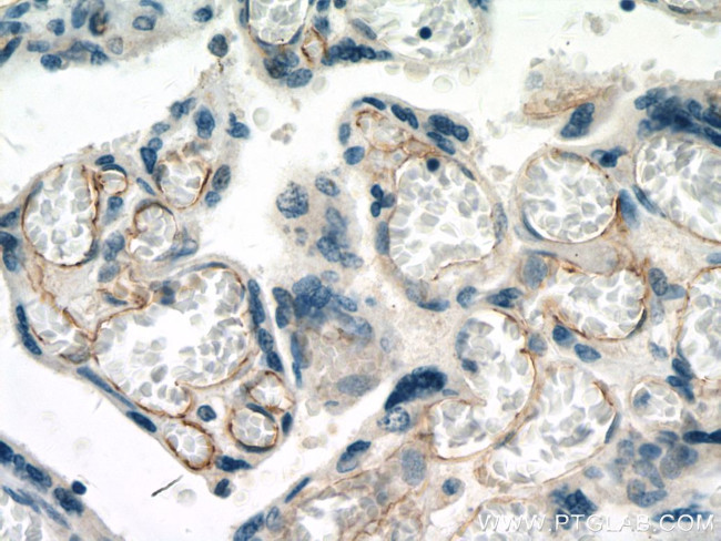 CDH5 Antibody in Immunohistochemistry (Paraffin) (IHC (P))