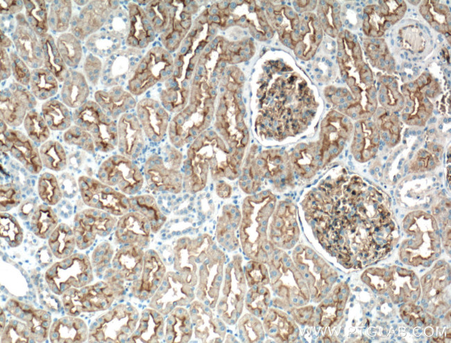 AQP1 Antibody in Immunohistochemistry (Paraffin) (IHC (P))