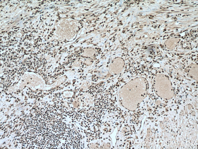 PABPN1 Antibody in Immunohistochemistry (Paraffin) (IHC (P))