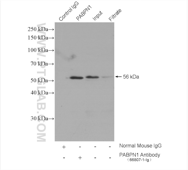 PABPN1 Antibody in Immunoprecipitation (IP)