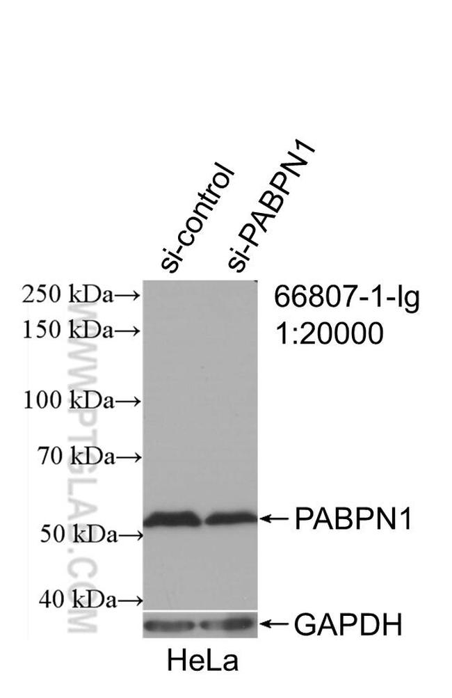 PABPN1 Antibody in Western Blot (WB)