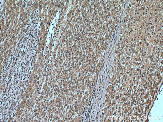 GCLM Antibody in Immunohistochemistry (Paraffin) (IHC (P))