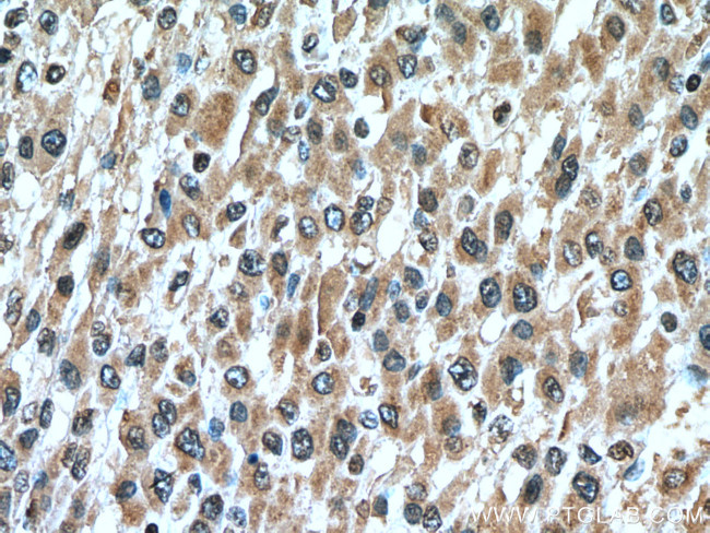 GCLM Antibody in Immunohistochemistry (Paraffin) (IHC (P))