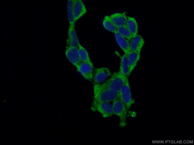 PABPC1/PABP Antibody in Immunocytochemistry (ICC/IF)