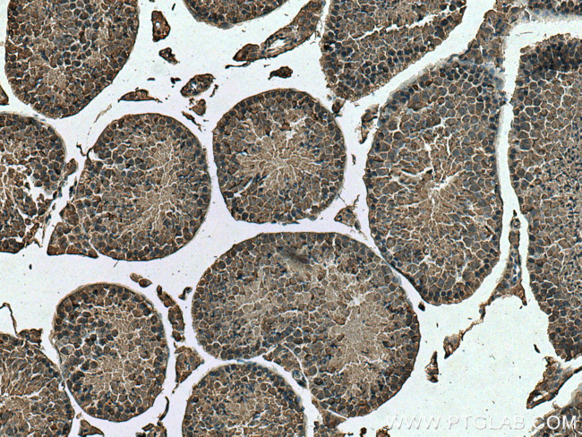 PABPC1/PABP Antibody in Immunohistochemistry (Paraffin) (IHC (P))