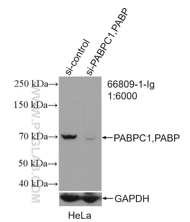 PABPC1/PABP Antibody in Western Blot (WB)