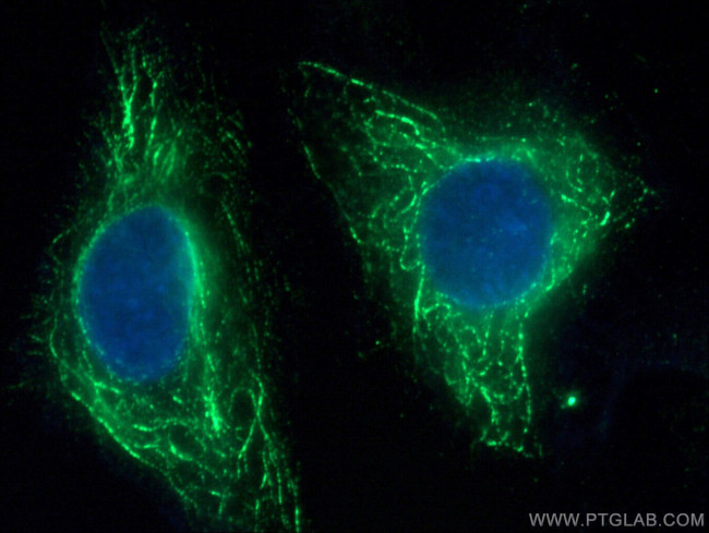 FFAR3 Antibody in Immunocytochemistry (ICC/IF)