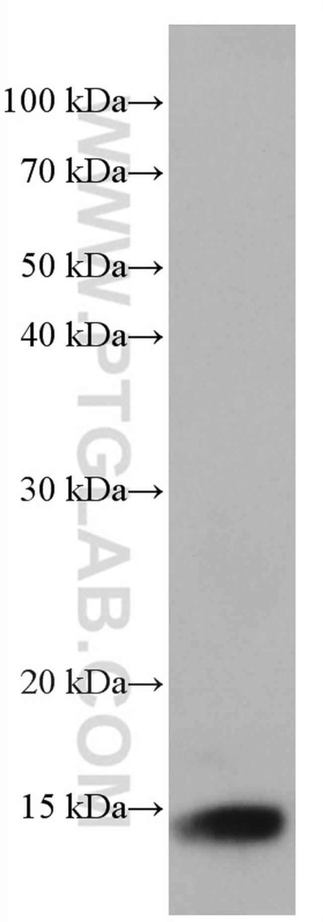 Cystatin B Antibody in Western Blot (WB)