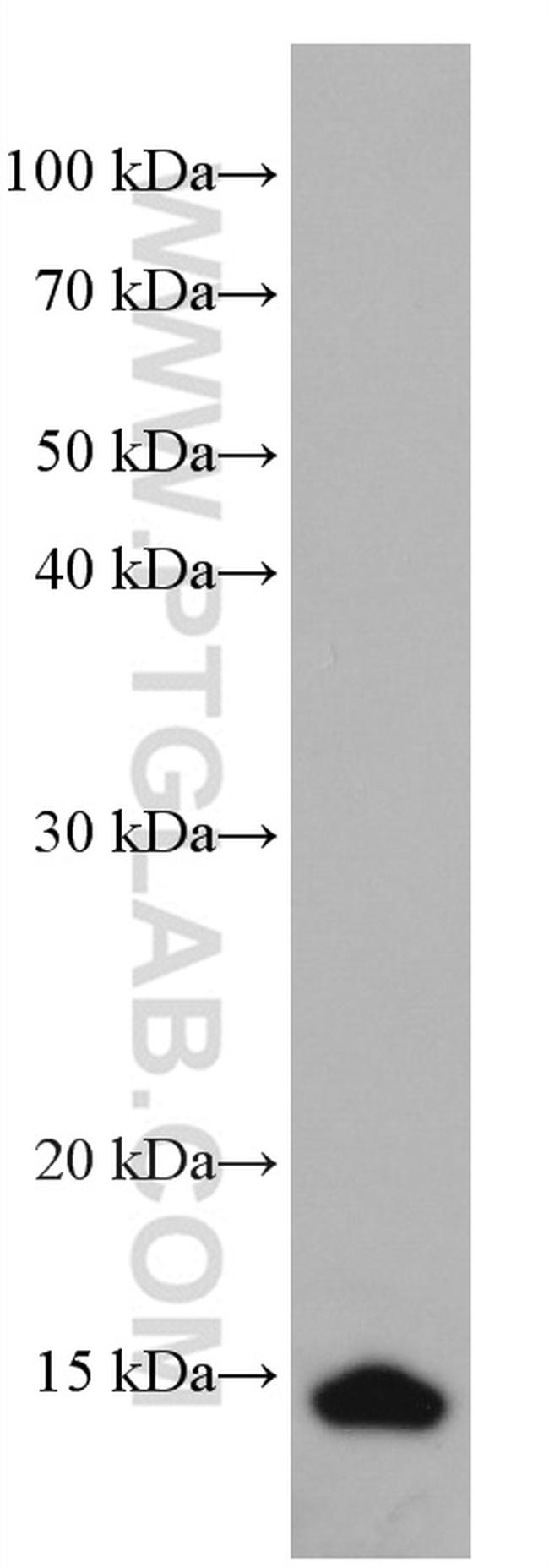 Cystatin B Antibody in Western Blot (WB)