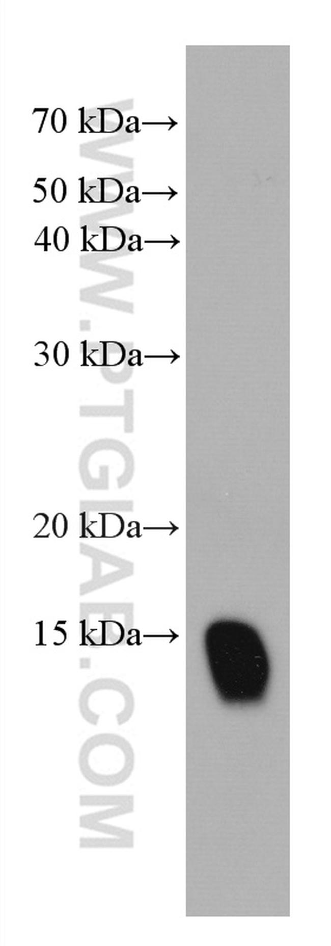 Cystatin B Antibody in Western Blot (WB)