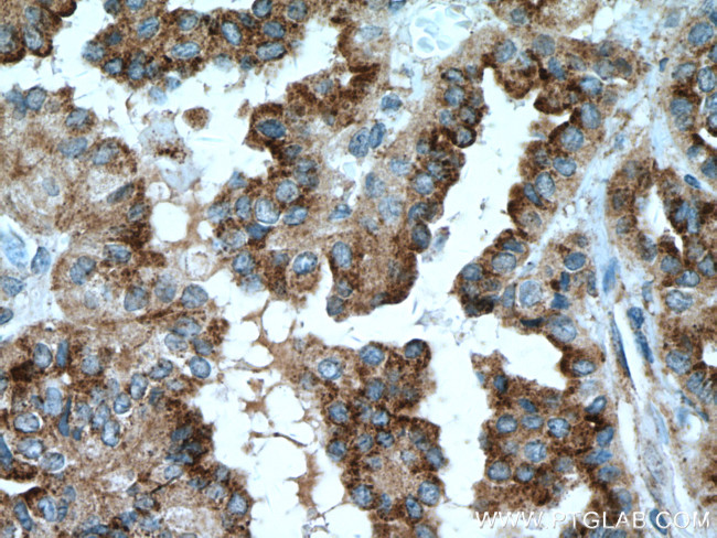 DIO2 Antibody in Immunohistochemistry (Paraffin) (IHC (P))