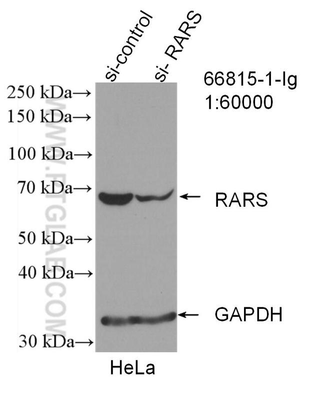 RARS Antibody in Western Blot (WB)