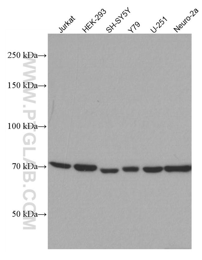 CHAT Antibody in Western Blot (WB)