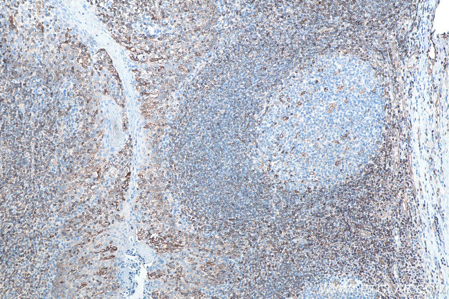 HLA-F Antibody in Immunohistochemistry (Paraffin) (IHC (P))