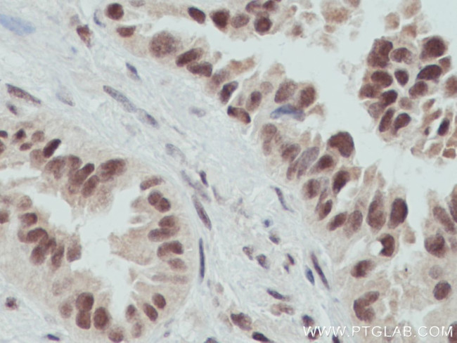 OGT Antibody in Immunohistochemistry (Paraffin) (IHC (P))