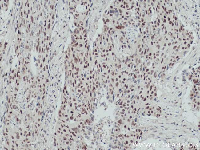 OGT Antibody in Immunohistochemistry (Paraffin) (IHC (P))