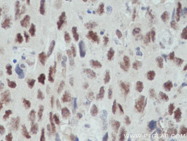 OGT Antibody in Immunohistochemistry (Paraffin) (IHC (P))