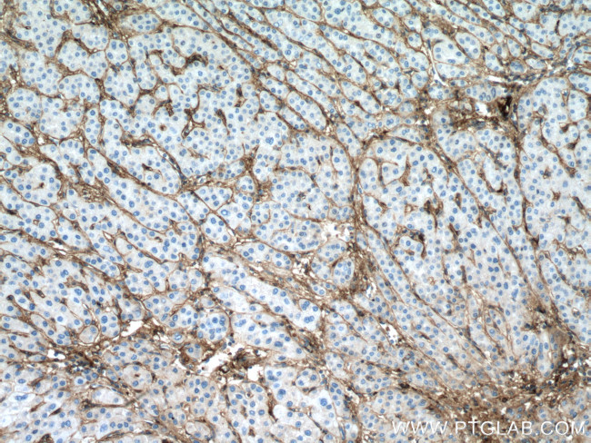 Collagen Type VI Antibody in Immunohistochemistry (Paraffin) (IHC (P))