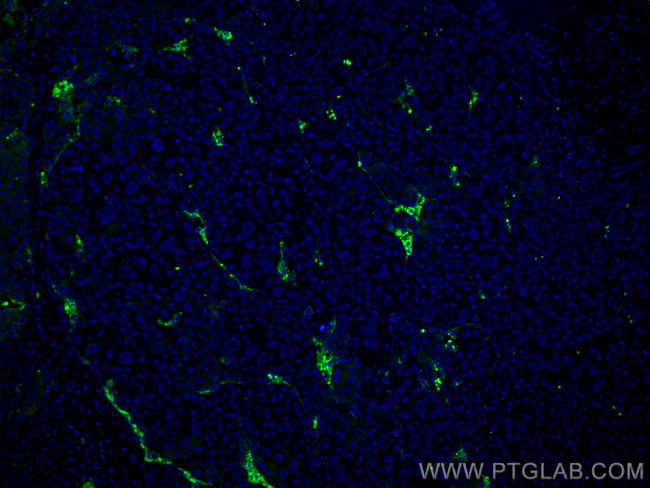 Collagen Type VI Antibody in Immunohistochemistry (PFA fixed) (IHC (PFA))