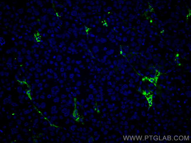 Collagen Type VI Antibody in Immunohistochemistry (PFA fixed) (IHC (PFA))