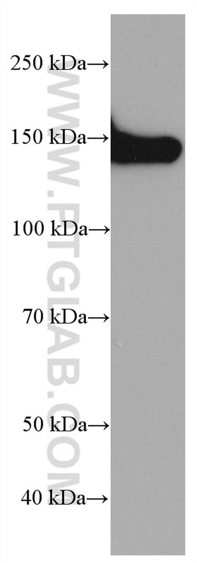 Collagen Type VI Antibody in Western Blot (WB)