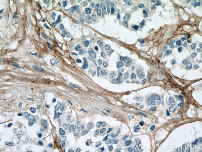 Collagen Type VI Antibody in Immunohistochemistry (Paraffin) (IHC (P))