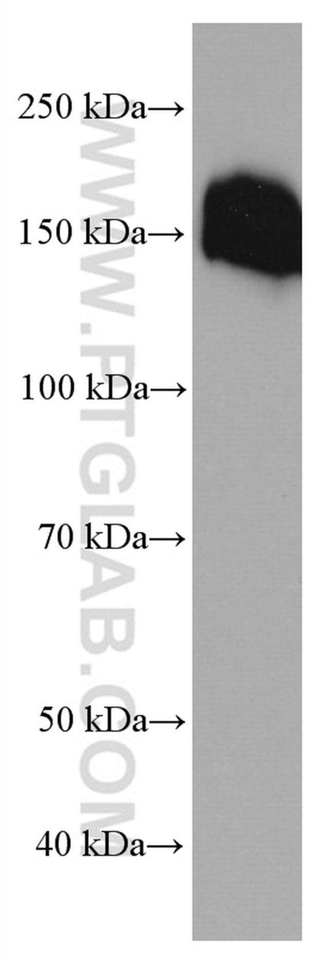 Collagen Type VI Antibody in Western Blot (WB)