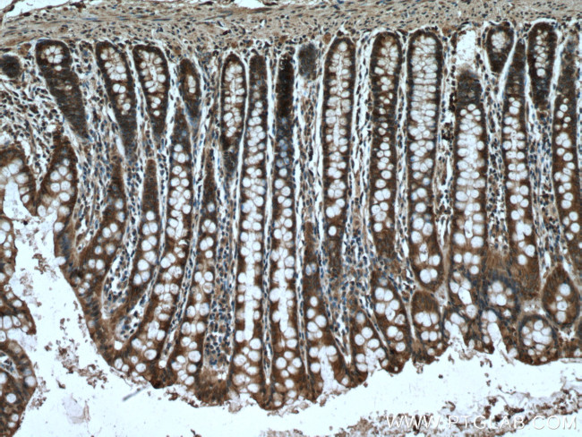 MYH14 Antibody in Immunohistochemistry (Paraffin) (IHC (P))