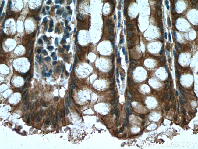 MYH14 Antibody in Immunohistochemistry (Paraffin) (IHC (P))