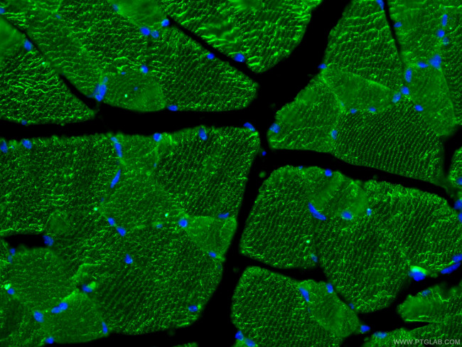 MYH14 Antibody in Immunohistochemistry (PFA fixed) (IHC (PFA))