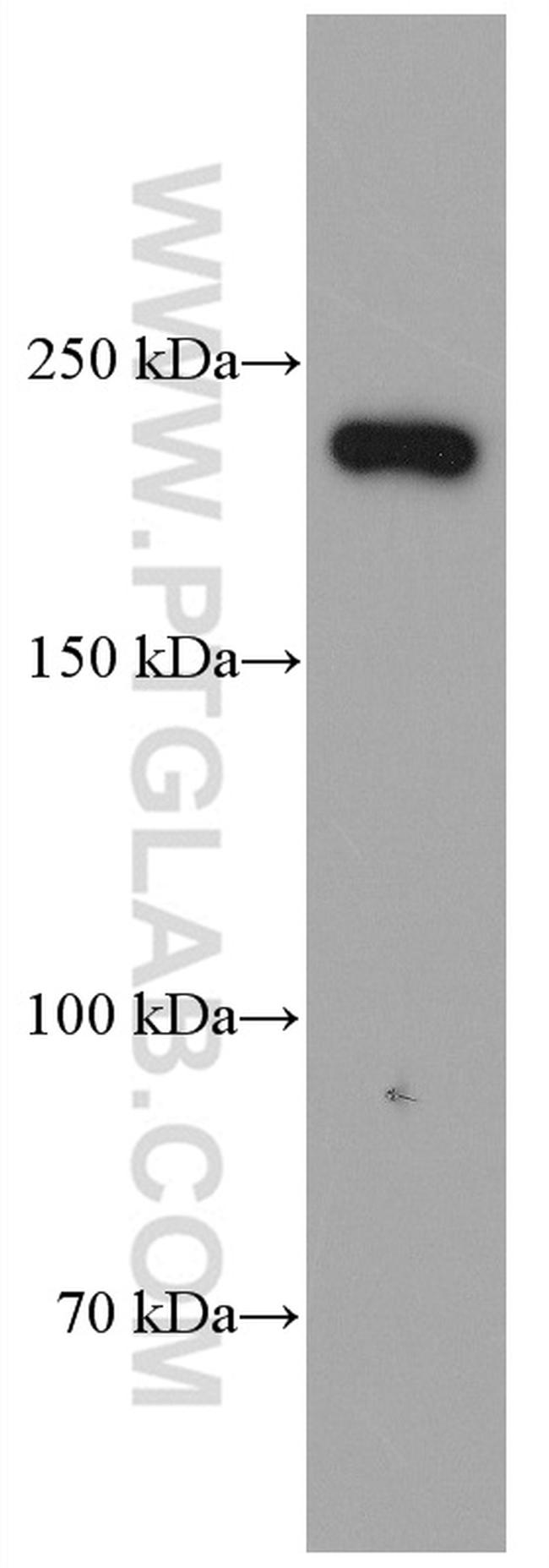 MYH14 Antibody in Western Blot (WB)