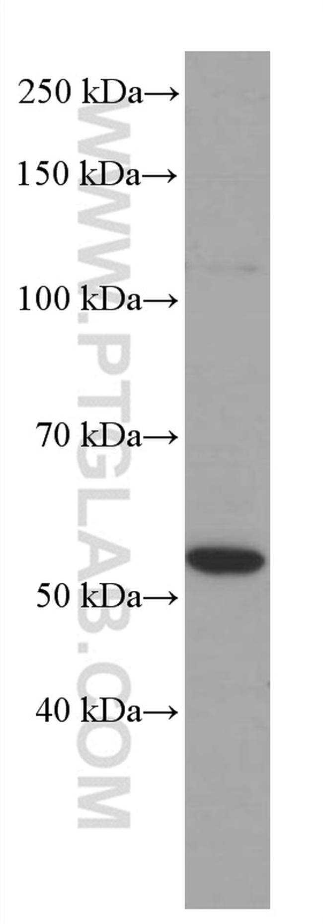 PPARA Antibody in Western Blot (WB)