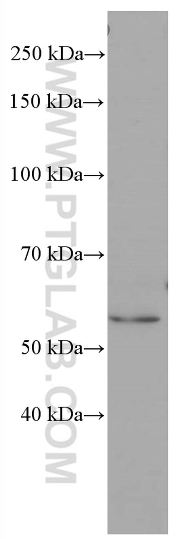 PPARA Antibody in Western Blot (WB)