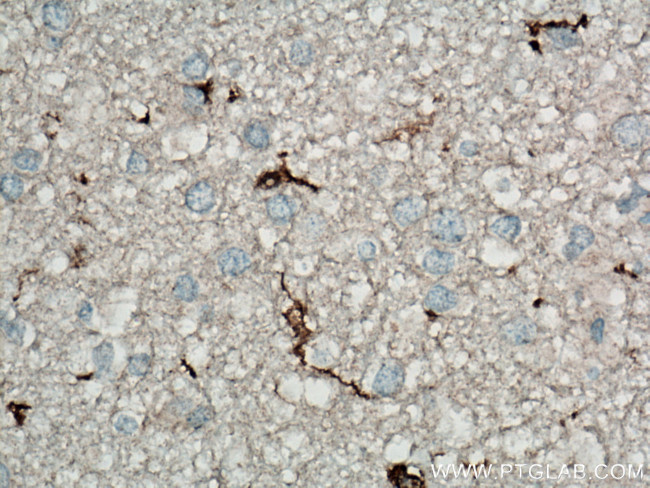 IBA1 Antibody in Immunohistochemistry (Paraffin) (IHC (P))