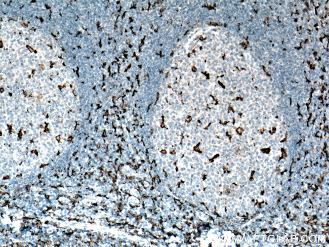 IBA1 Antibody in Immunohistochemistry (Paraffin) (IHC (P))