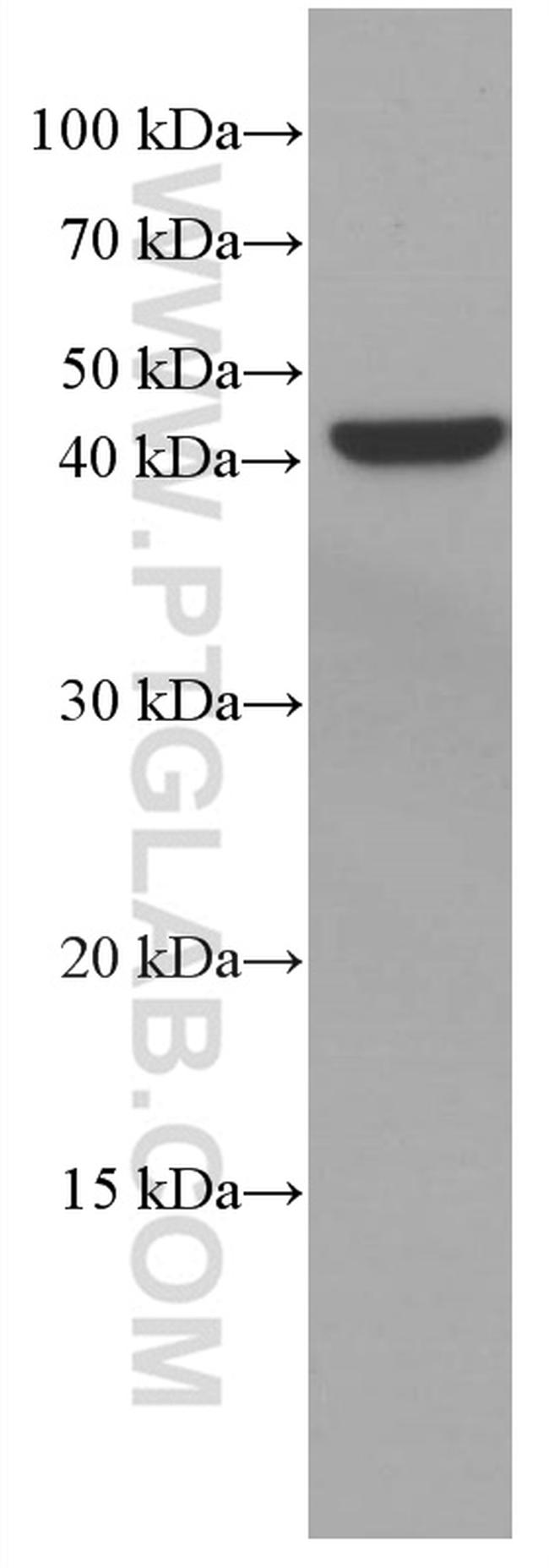 VEGFA Antibody in Western Blot (WB)