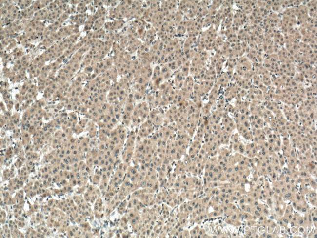 VEGFA Antibody in Immunohistochemistry (Paraffin) (IHC (P))