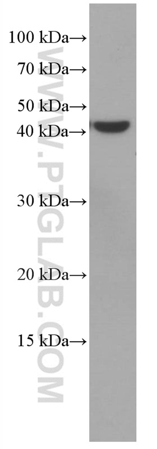 VEGFA Antibody in Western Blot (WB)