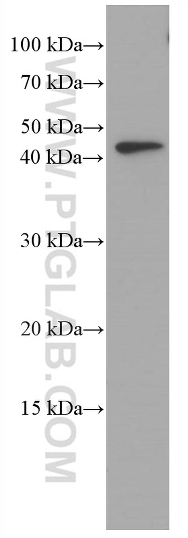 VEGFA Antibody in Western Blot (WB)