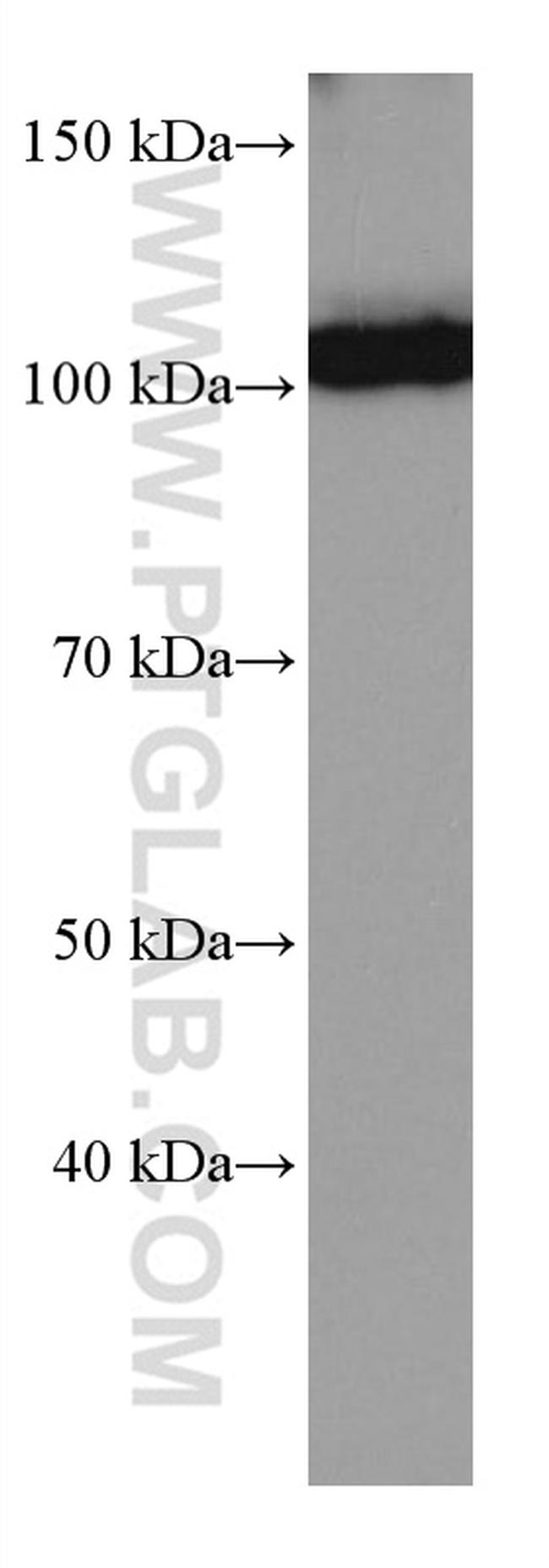 IL-12RB1 Antibody in Western Blot (WB)