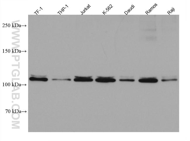 IL-12RB1 Antibody in Western Blot (WB)