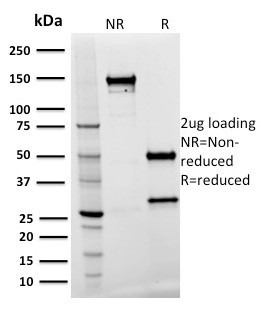 Spastin Antibody in SDS-PAGE (SDS-PAGE)