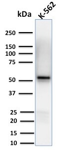 Spastin Antibody in Western Blot (WB)