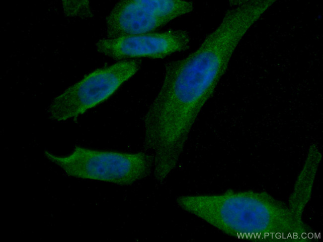 APOE Antibody in Immunocytochemistry (ICC/IF)