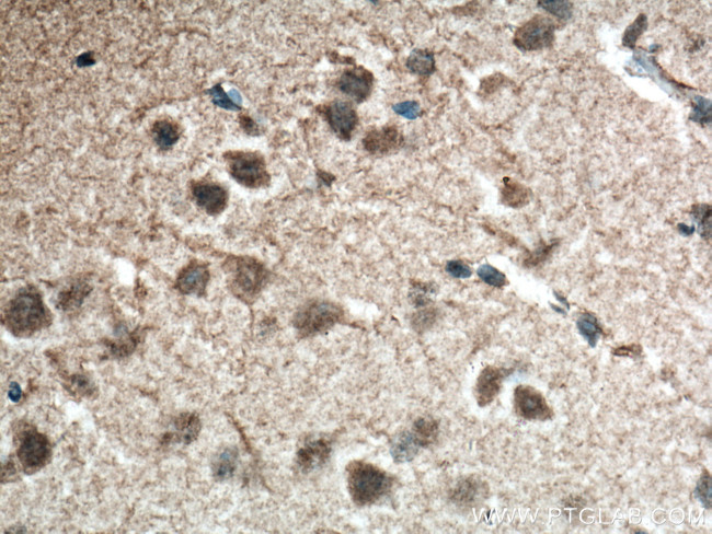 APOE Antibody in Immunohistochemistry (Paraffin) (IHC (P))