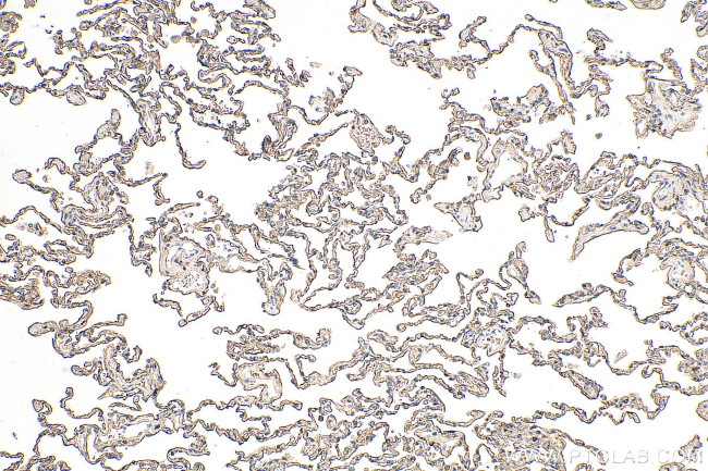 AGER Antibody in Immunohistochemistry (Paraffin) (IHC (P))