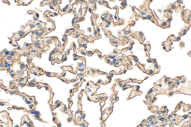 AGER Antibody in Immunohistochemistry (Paraffin) (IHC (P))